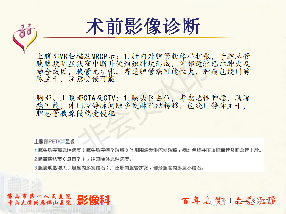 影像PPT - 【病例】胰腺淋巴瘤1例CT及MR影像-19