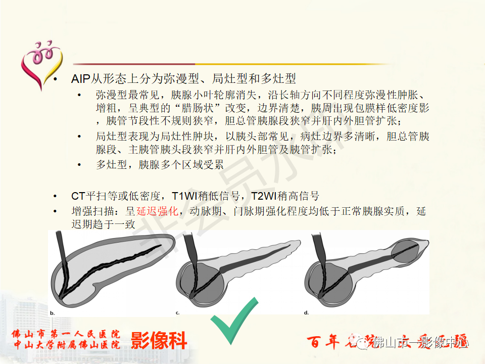影像PPT - 【病例】胰腺淋巴瘤1例CT及MR影像-39