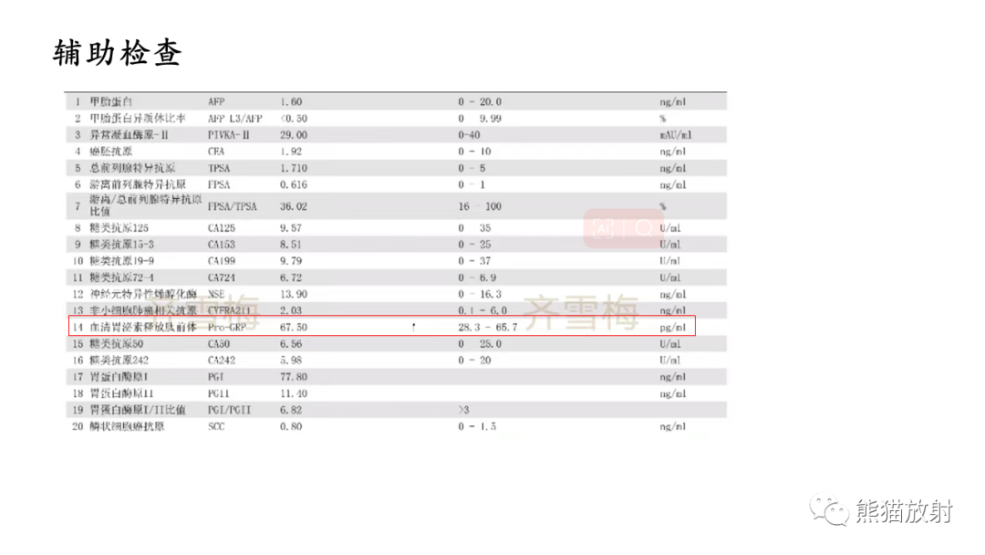 影像PPT - 【病例】胃壁结节异位胰腺 VS 胃肠道间质瘤-3