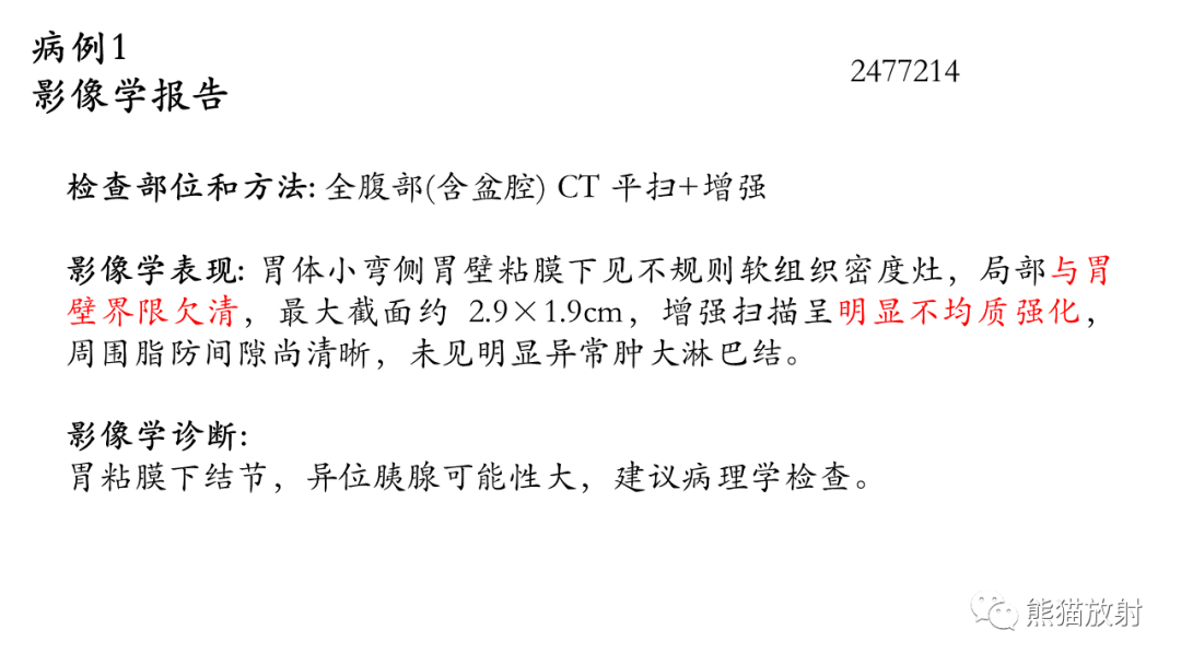 影像PPT - 【病例】胃壁结节异位胰腺 VS 胃肠道间质瘤-11