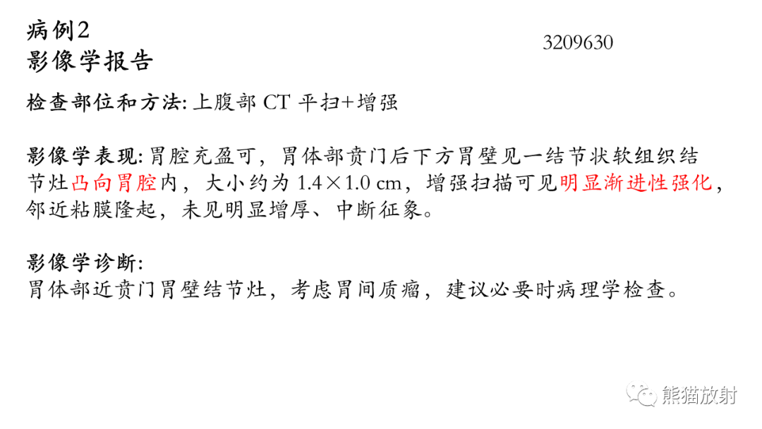 影像PPT - 【病例】胃壁结节异位胰腺 VS 胃肠道间质瘤-13