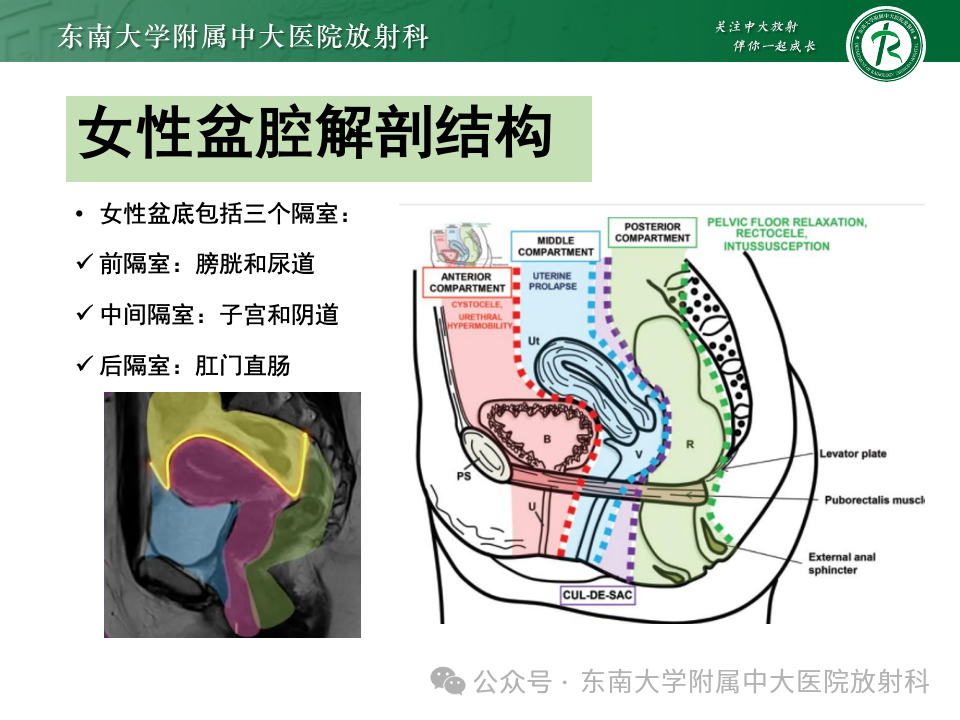 影像PPT - 【PPT】女性盆腔内腹膜外占位性病变-4