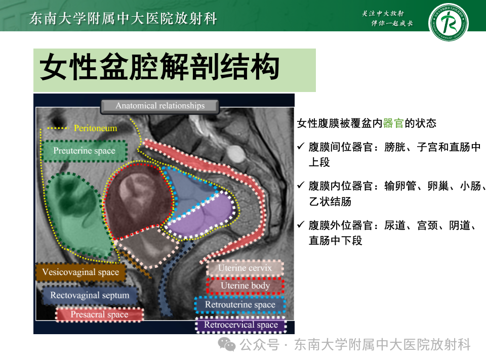 影像PPT - 【PPT】女性盆腔内腹膜外占位性病变-3