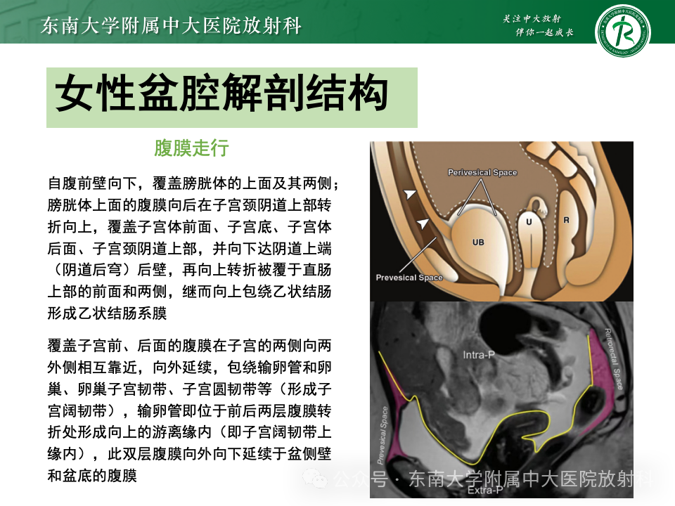 影像PPT - 【PPT】女性盆腔内腹膜外占位性病变-2