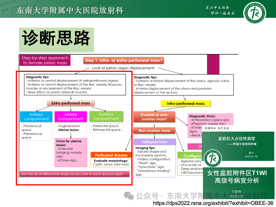 影像PPT - 【PPT】女性盆腔内腹膜外占位性病变-6