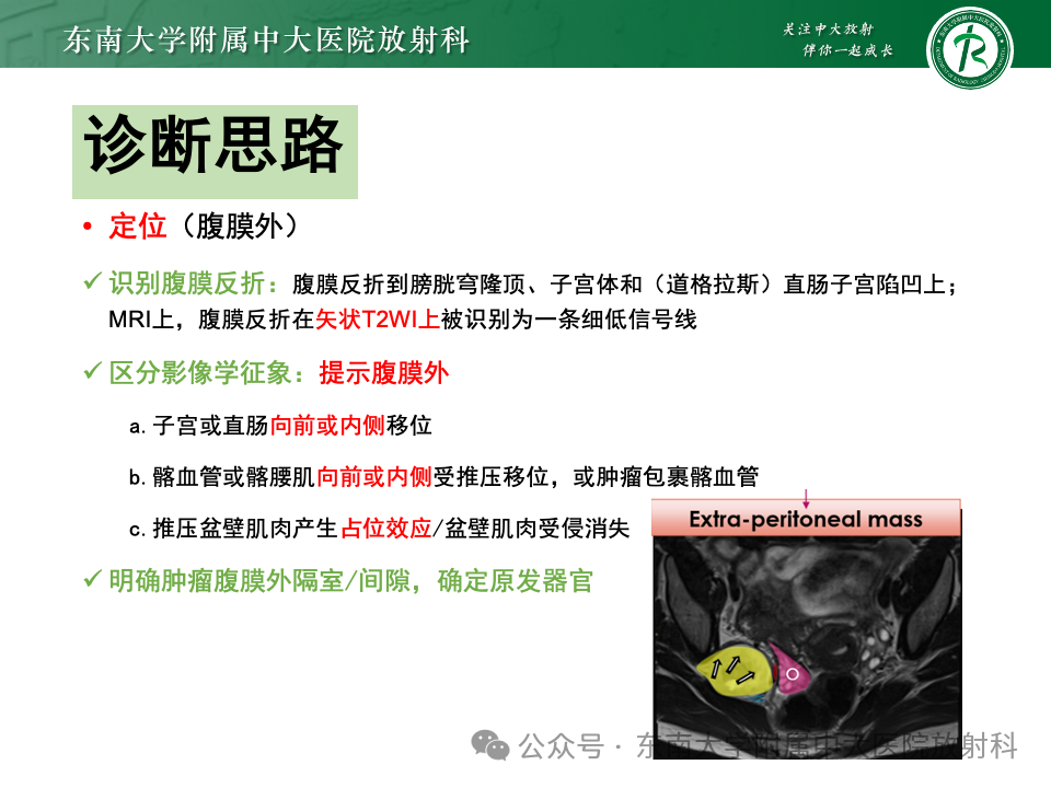影像PPT - 【PPT】女性盆腔内腹膜外占位性病变-7