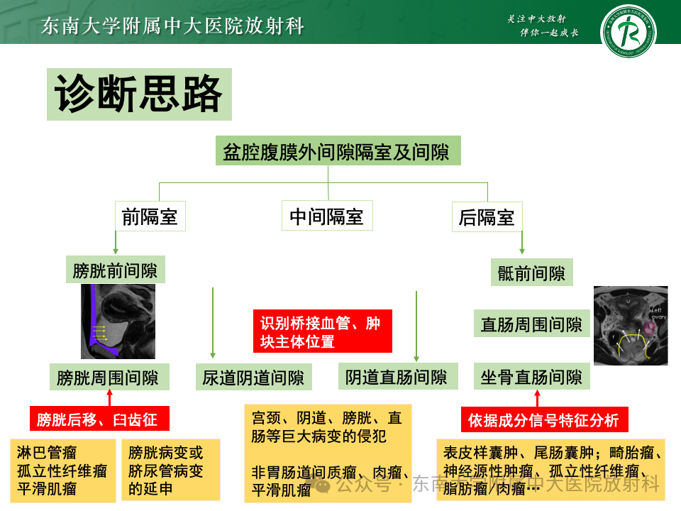 影像PPT - 【PPT】女性盆腔内腹膜外占位性病变-8