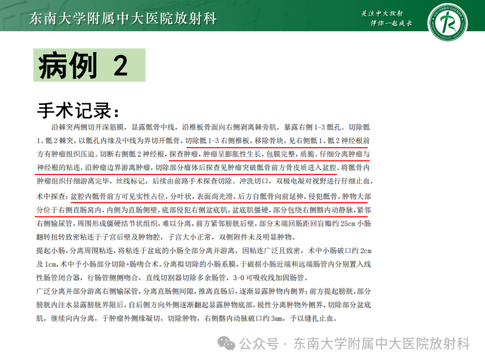 影像PPT - 【PPT】女性盆腔内腹膜外占位性病变-16