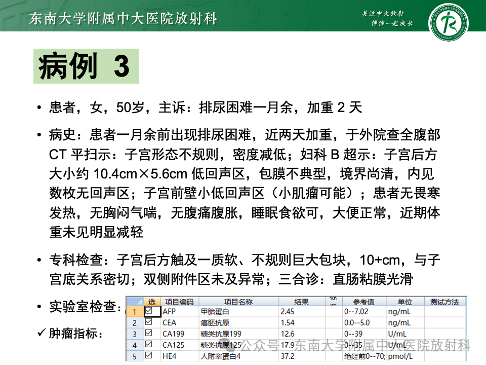 影像PPT - 【PPT】女性盆腔内腹膜外占位性病变-18
