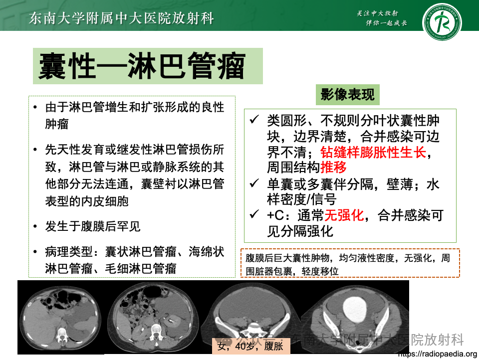 影像PPT - 【PPT】女性盆腔内腹膜外占位性病变-23