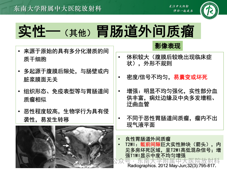 影像PPT - 【PPT】女性盆腔内腹膜外占位性病变-42