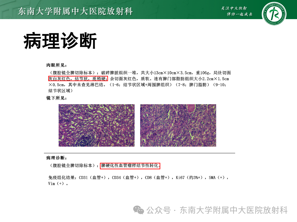 影像PPT - 【PPT】脾脏硬化性血管瘤样结节性转化-4