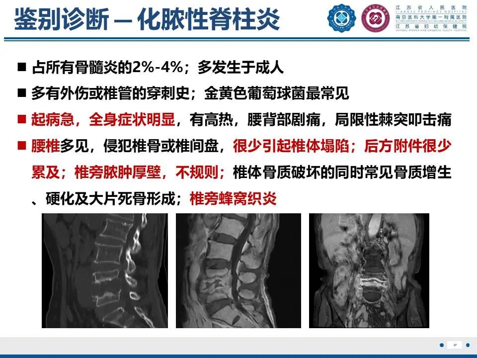 影像PPT - 【PPT】脊柱结核-28