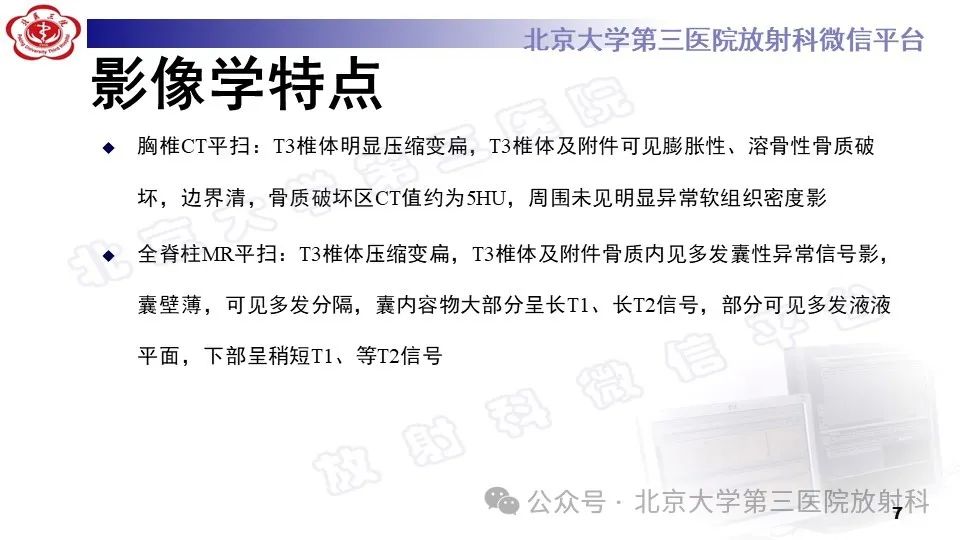 影像PPT - 【PPT】胸椎动脉瘤样骨囊肿-6