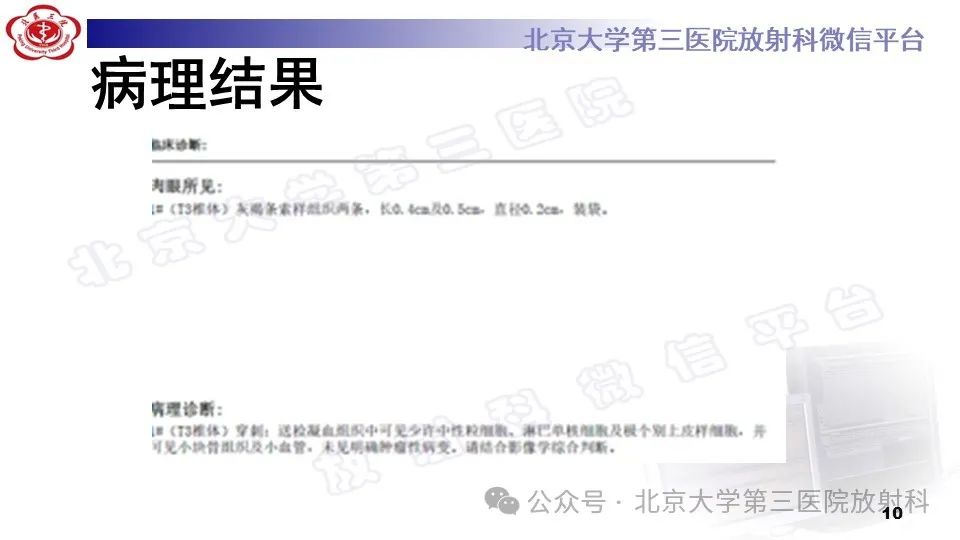 影像PPT - 【PPT】胸椎动脉瘤样骨囊肿-9