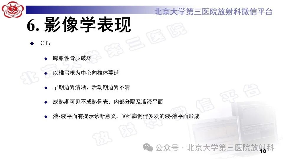 影像PPT - 【PPT】胸椎动脉瘤样骨囊肿-17