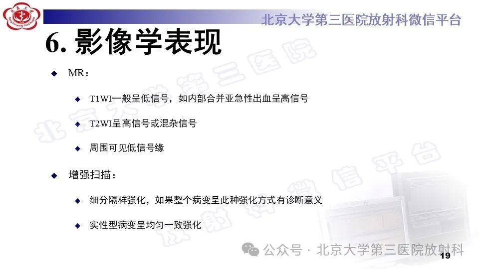 影像PPT - 【PPT】胸椎动脉瘤样骨囊肿-18