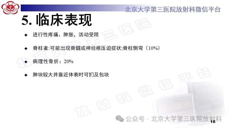 影像PPT - 【PPT】胸椎动脉瘤样骨囊肿-15