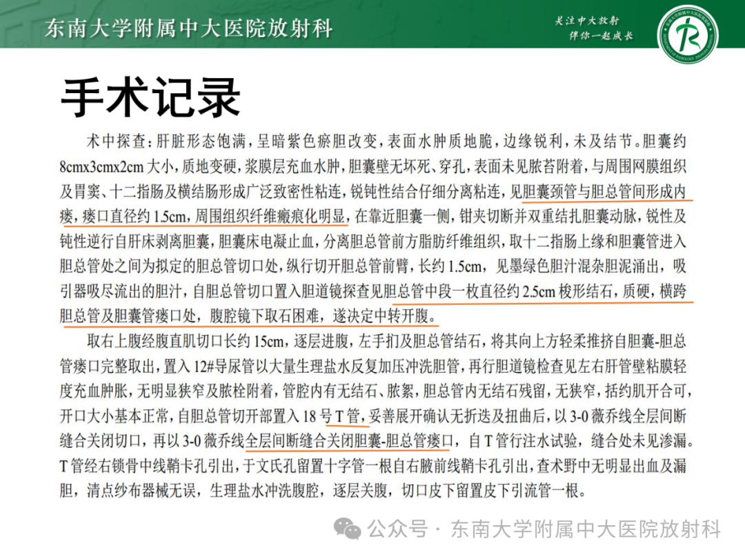 影像PPT - 【PPT】Mirizzi综合征-3
