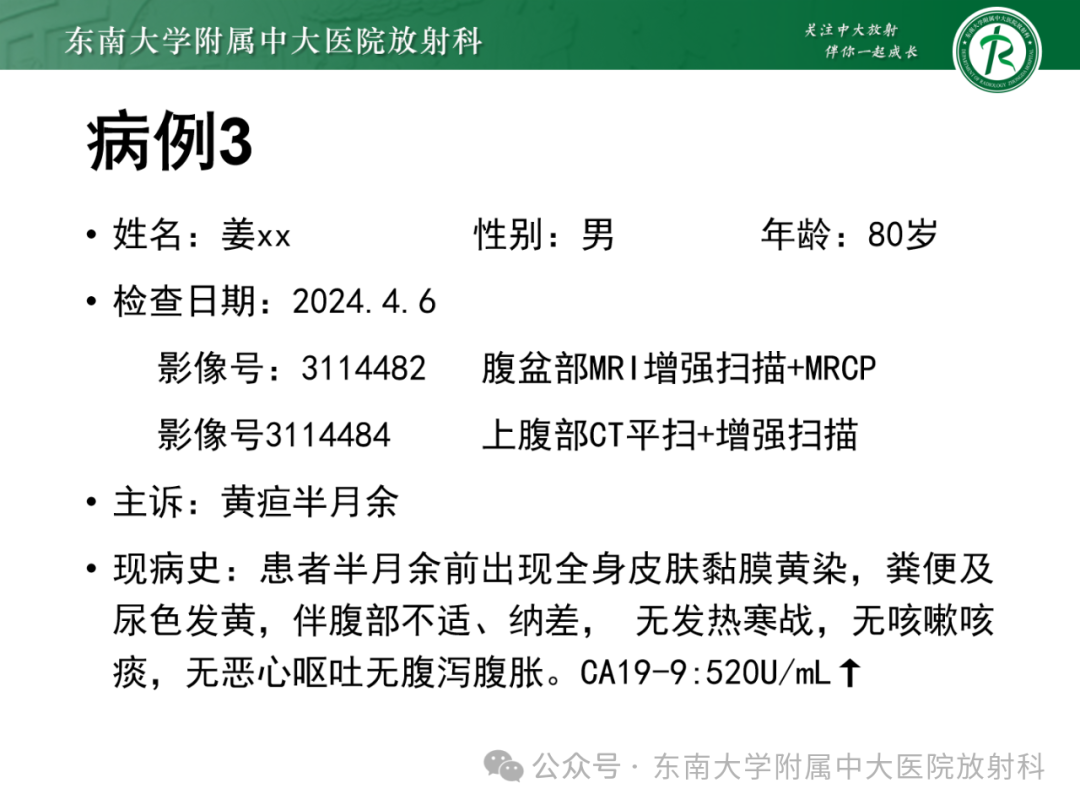 影像PPT - 【PPT】Mirizzi综合征-24