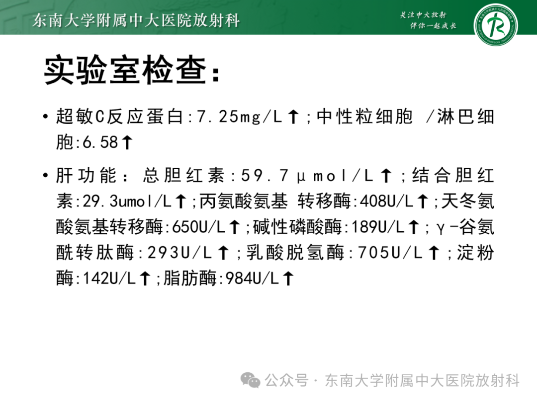 影像PPT - 【PPT】Mirizzi综合征-19