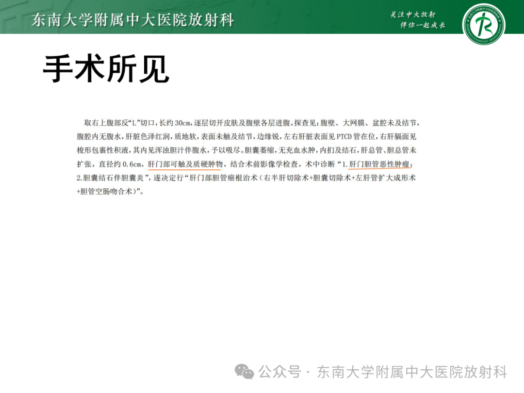 影像PPT - 【PPT】Mirizzi综合征-27