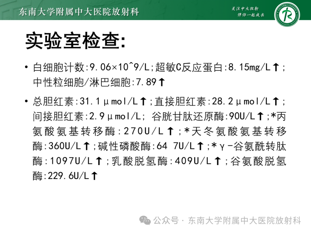 影像PPT - 【PPT】Mirizzi综合征-31