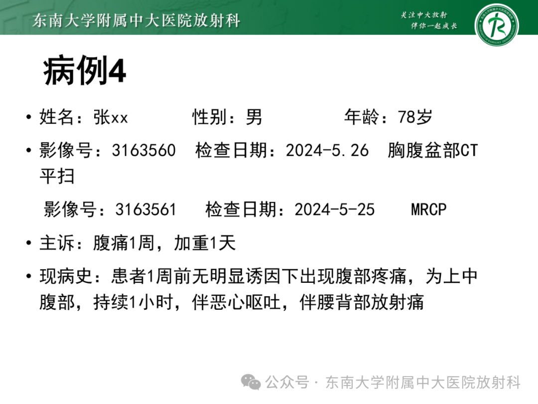 影像PPT - 【PPT】Mirizzi综合征-30