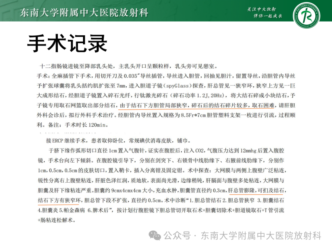 影像PPT - 【PPT】Mirizzi综合征-33
