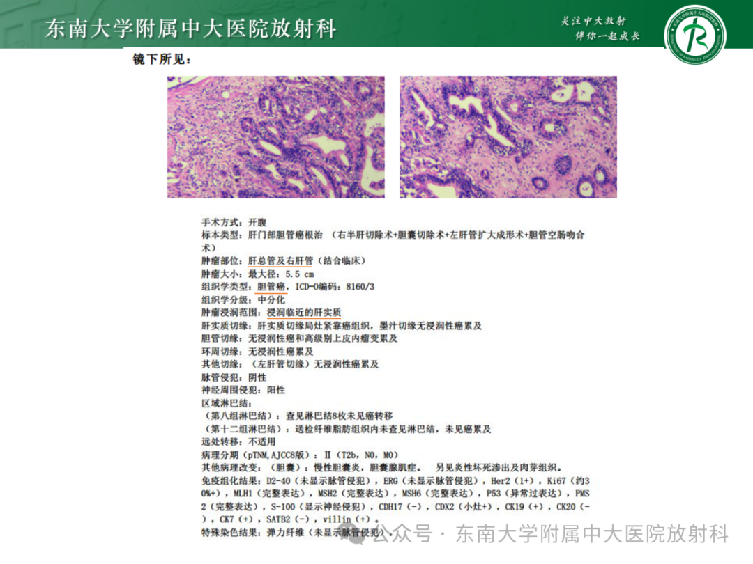 影像PPT - 【PPT】Mirizzi综合征-1