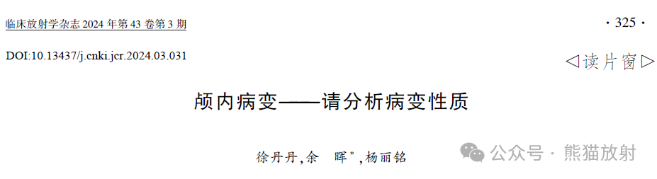 影像PPT - 【病例】IgG4相关性肥厚性硬脑膜炎1例CT及MR影像-6 影像PPT - 【病例】IgG4相关性肥厚性硬脑膜炎1例CT及MR影像-6