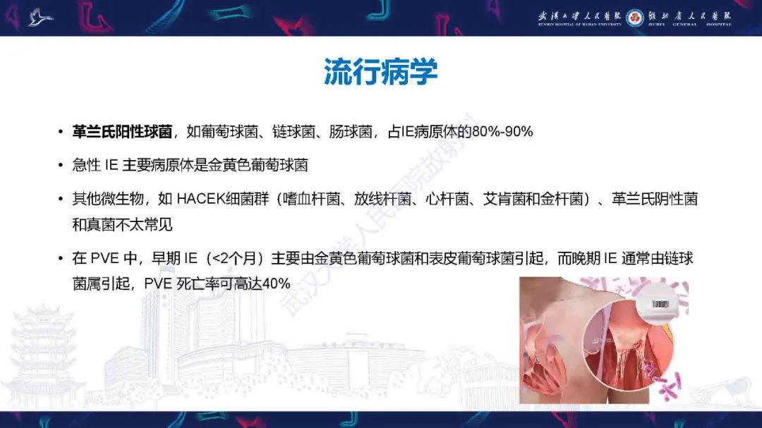 影像PPT - 【PPT】感染性心内膜炎CT诊断-5