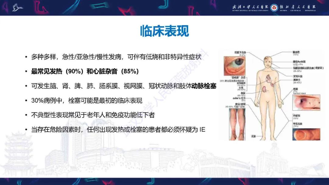 影像PPT - 【PPT】感染性心内膜炎CT诊断-6