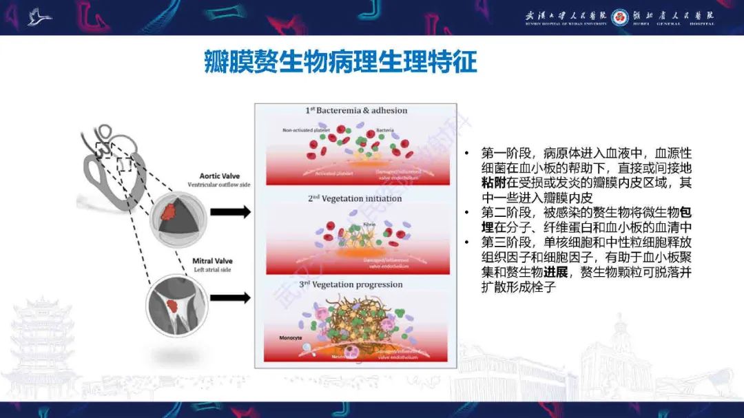 影像PPT - 【PPT】感染性心内膜炎CT诊断-17