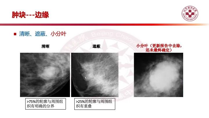 影像PPT - 【PPT】乳腺x线征象解读-9