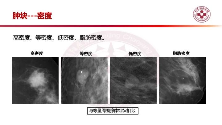 影像PPT - 【PPT】乳腺x线征象解读-11