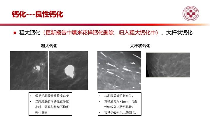 影像PPT - 【PPT】乳腺x线征象解读-18