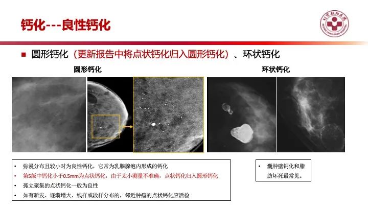 影像PPT - 【PPT】乳腺x线征象解读-19