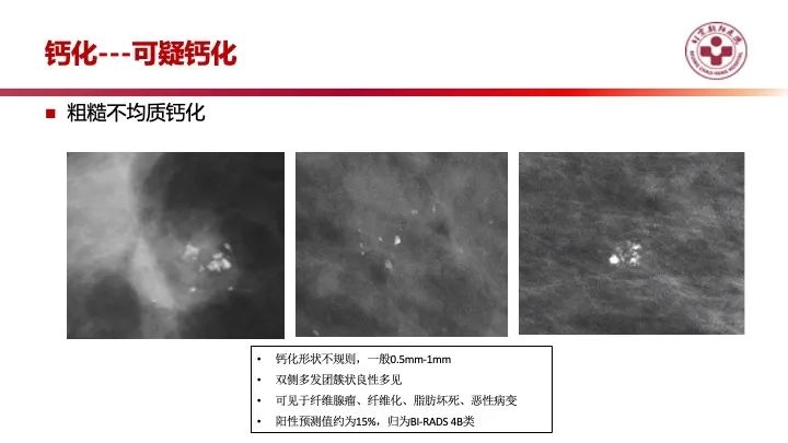 影像PPT - 【PPT】乳腺x线征象解读-23
