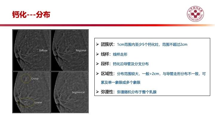影像PPT - 【PPT】乳腺x线征象解读-26