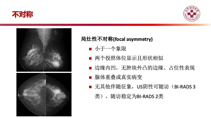 影像PPT - 【PPT】乳腺x线征象解读-34