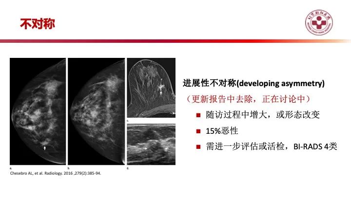 影像PPT - 【PPT】乳腺x线征象解读-36