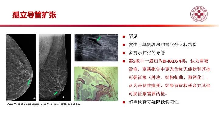 影像PPT - 【PPT】乳腺x线征象解读-39