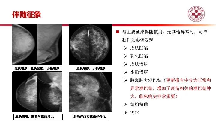 影像PPT - 【PPT】乳腺x线征象解读-41