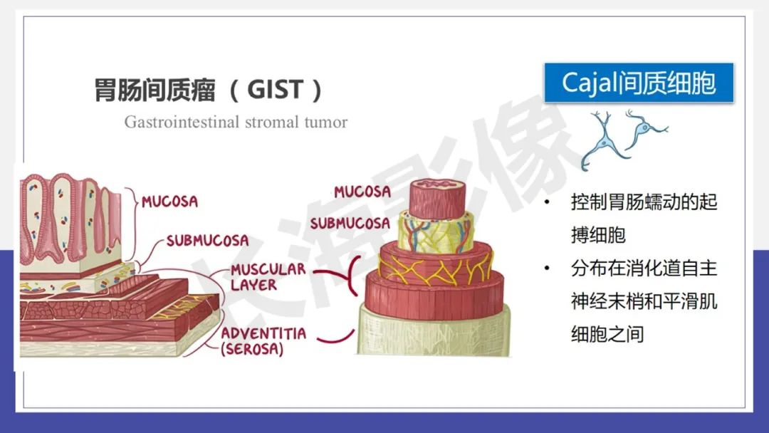 影像PPT - 【PPT 】胃肠间质瘤-6