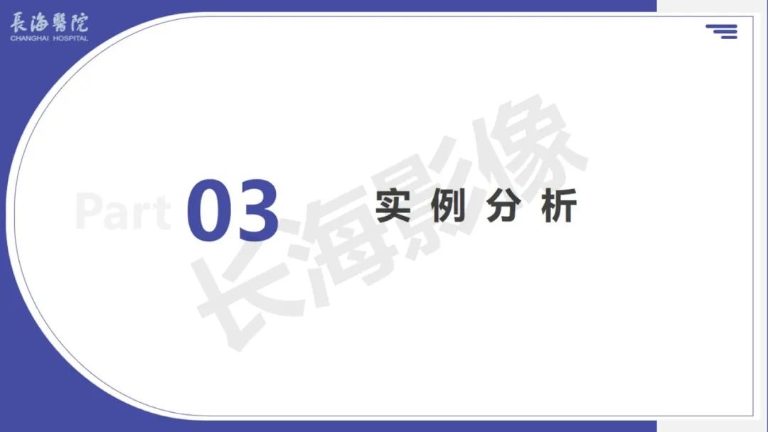 影像PPT - 【PPT 】胃肠间质瘤-15