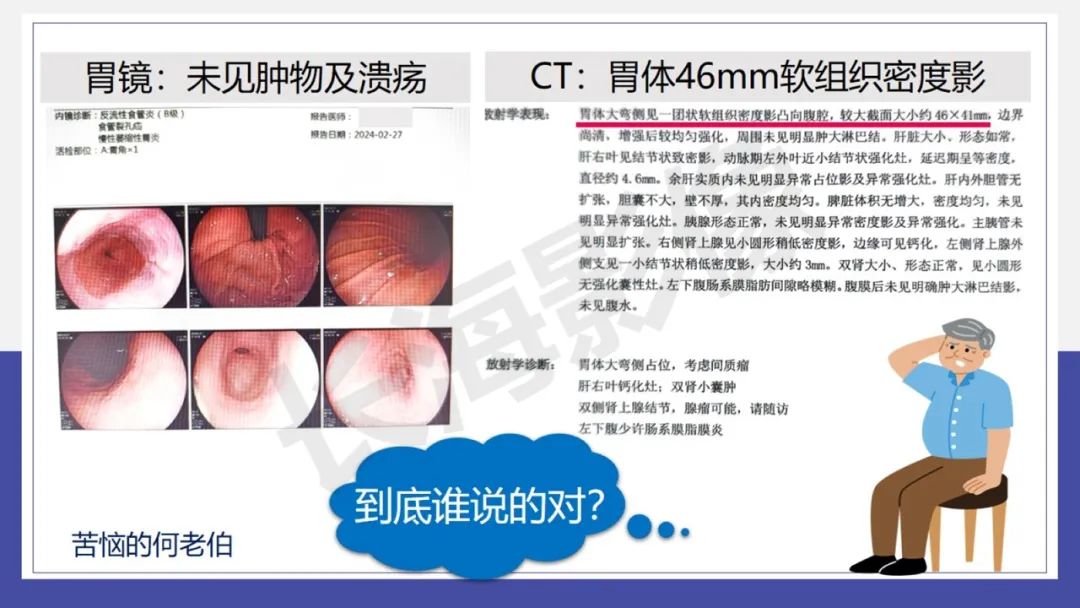 影像PPT - 【PPT 】胃肠间质瘤-16