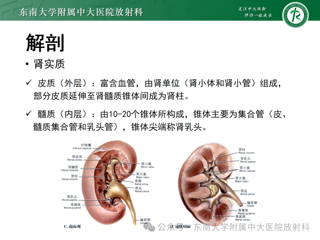 影像PPT - 【PPT】肾嫌色细胞癌-9 影像PPT - 【PPT】肾嫌色细胞癌-9