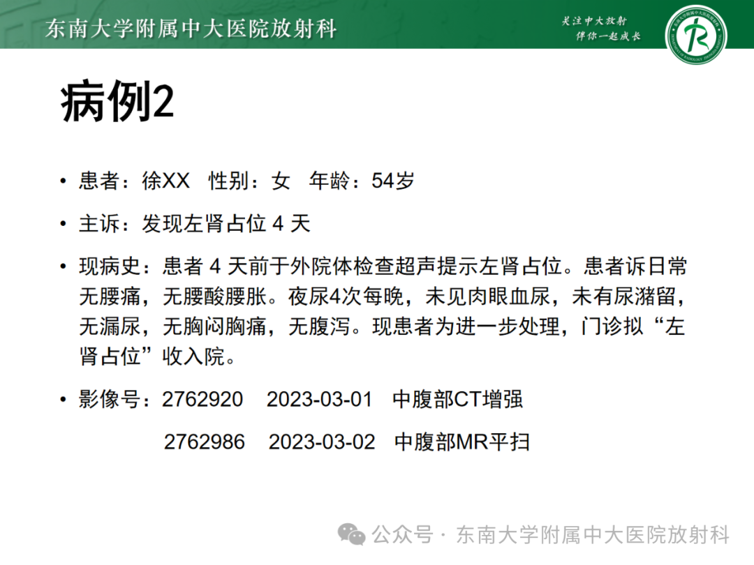 影像PPT - 【PPT】肾嫌色细胞癌-20 影像PPT - 【PPT】肾嫌色细胞癌-20