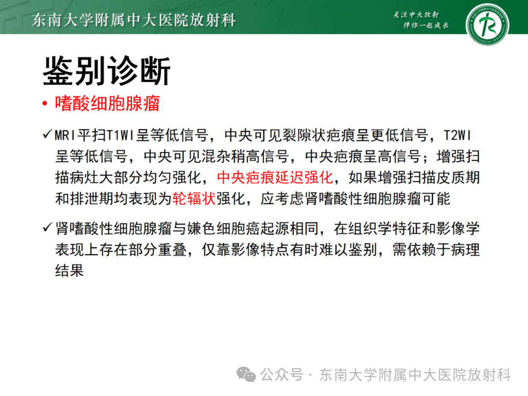 影像PPT - 【PPT】肾嫌色细胞癌-31 影像PPT - 【PPT】肾嫌色细胞癌-31